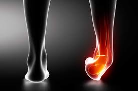Image result for ankle injury